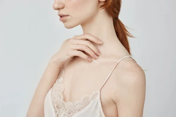 woman with liposuction neck and chin