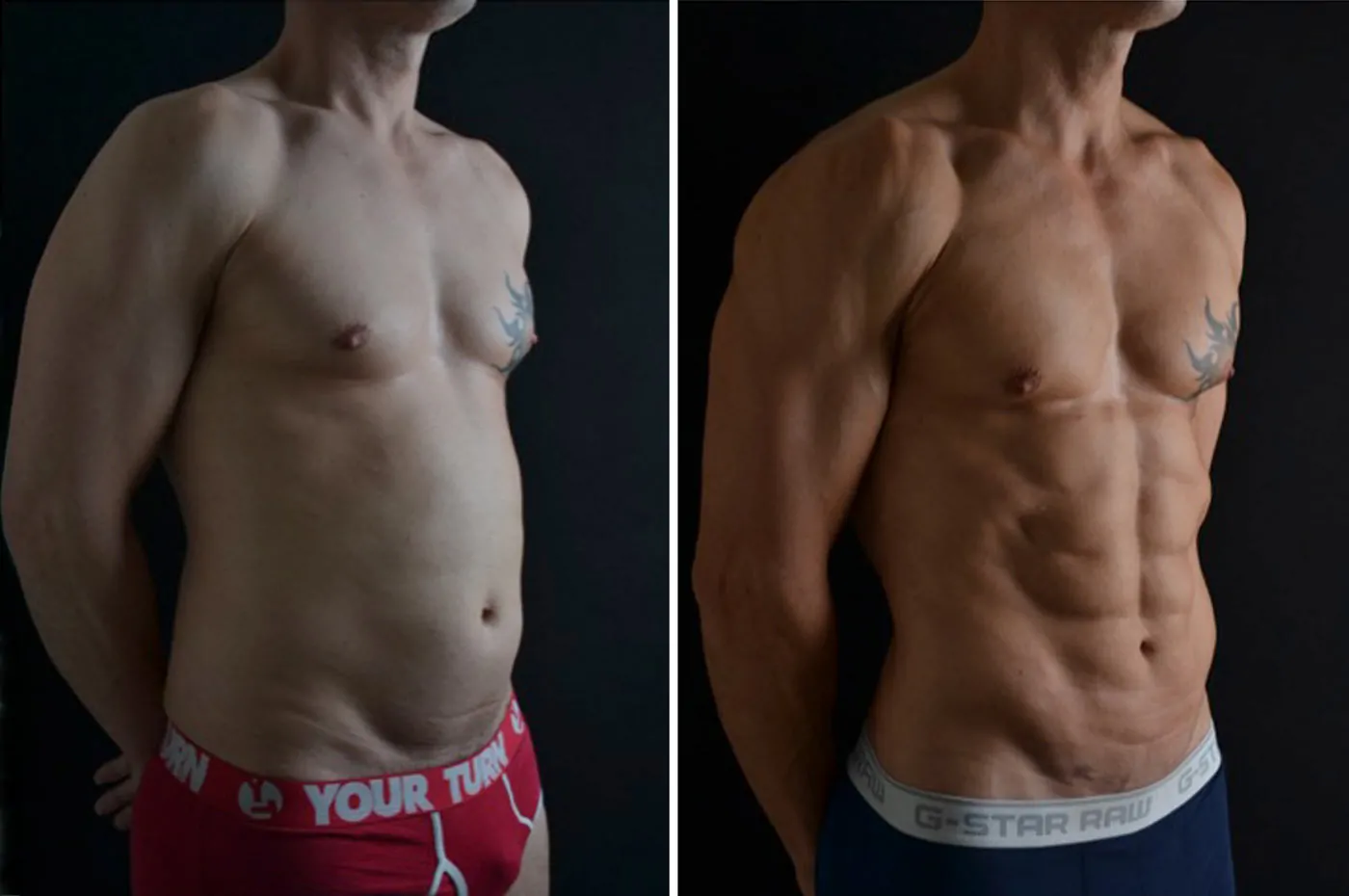 Male high definition liposuction before (left) and after (right)