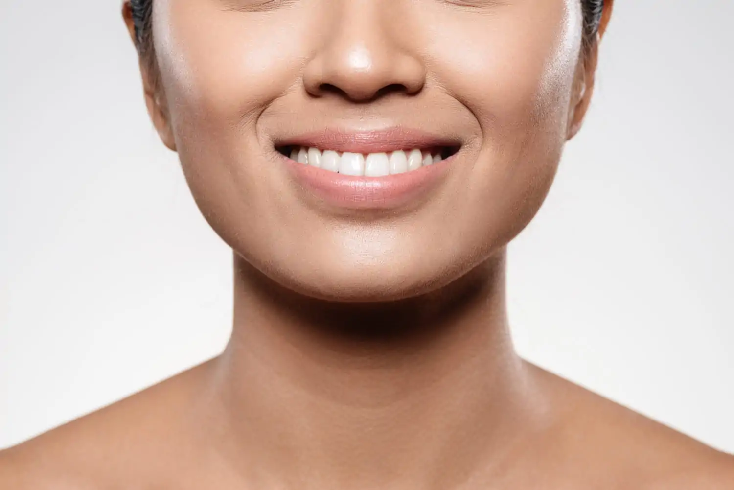 woman with Jawline Fillers result