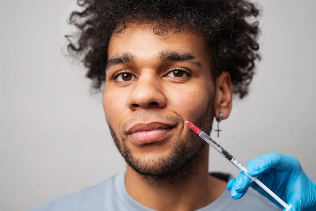 A young man smiling confidently while receiving a Botox injection at the corner of his mouth to smooth out fine lines and wrinkles.
