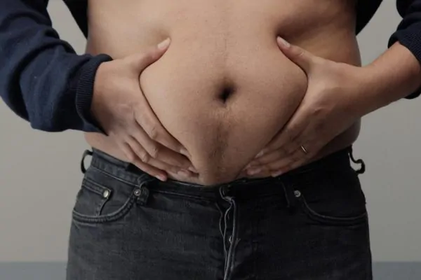 Close-up shot of a big belly before HD liposuction