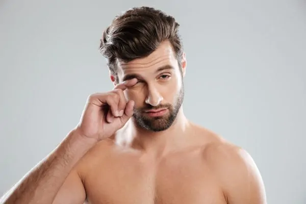 Man experiencing temporary side effects of Botox