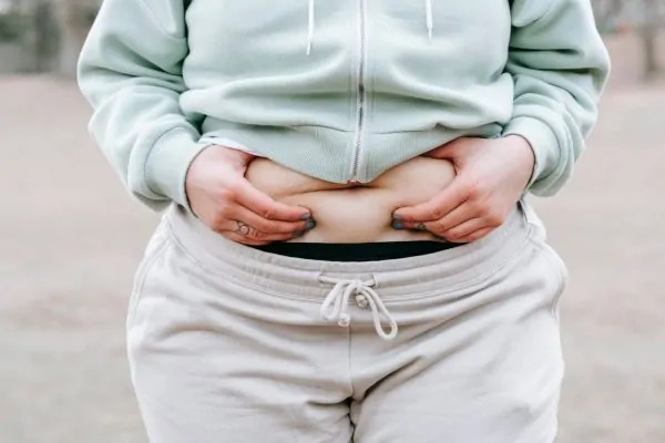 A woman pinching her belly before a lipo procedure