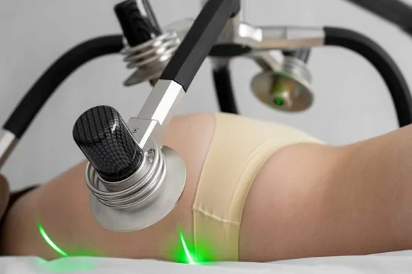 A woman undergoing laser liposuction
