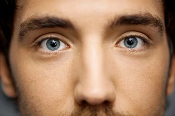 Close-up shot of a man's upper face after getting Botox