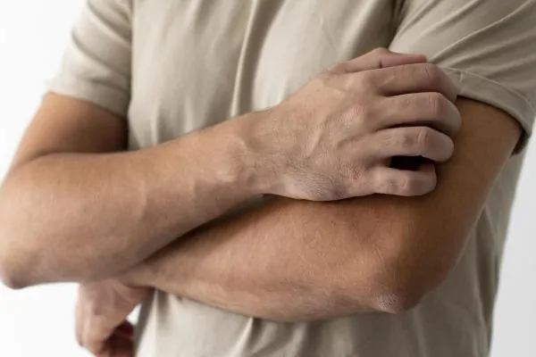 A man who underwent arm liposuction.