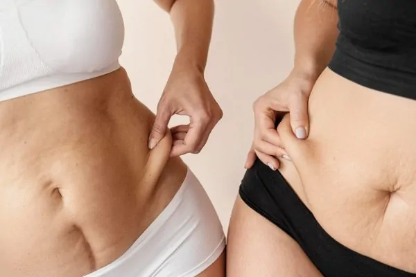 Women showing off their bellies