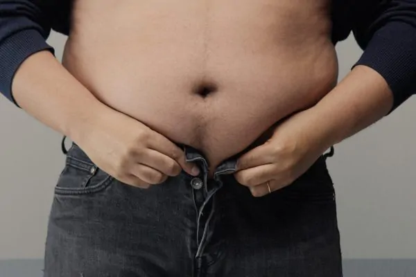 Close up shot a belly before liposuction