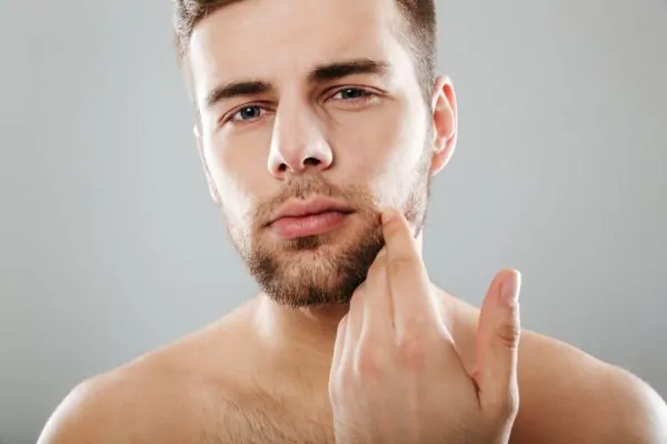 Handsome man after getting jawline fillers