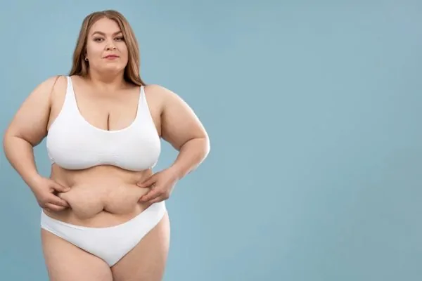 Young oversized woman posing in white lingerie before getting liposuction procedure