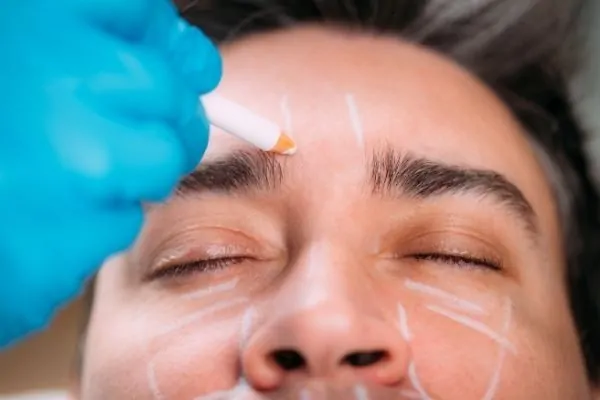 Dermal fillers are a non-surgical plastic surgery procedure