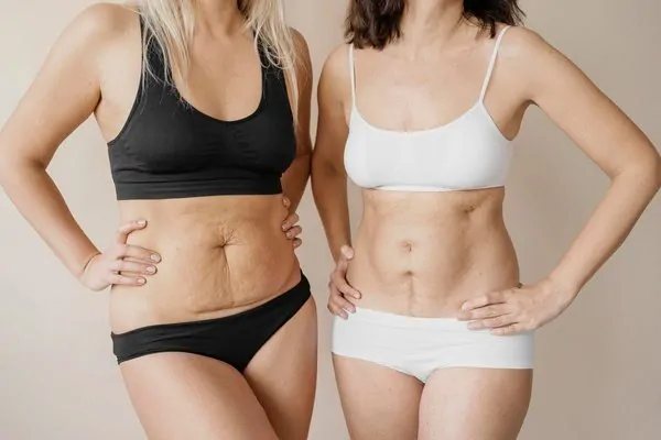Image shows if a Mommy Makeover Right for You