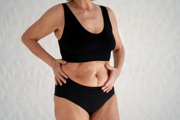 Mature woman in black athletic wear showing abdominal area with loose skin, demonstrating typical concerns addressed by tummy tuck surgery in women over 50