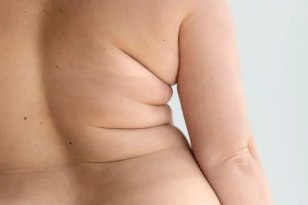 Curvy woman posing confidently with body Fat