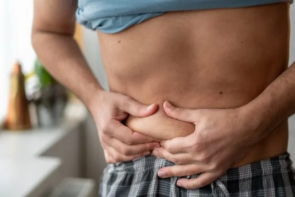 Person having Excess Skin