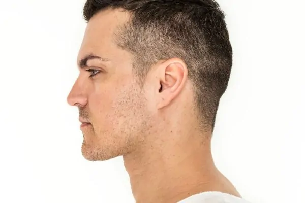 portrait of man neck liposuction